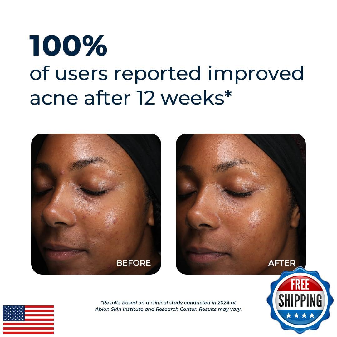 VitaMedica Clear Skin Vitamin Formula | Noncystic Acne Supplement for Skin Cl