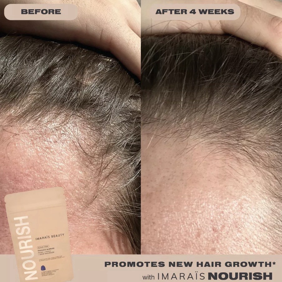Nourish Imaraïs Haircare Gummies For HairGrowth, anti-shedding- 30ct EXP:10/2026