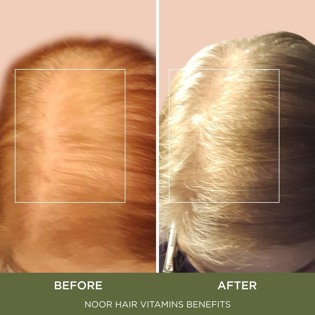 3x (BRANDED) NOOR HAIR Healthy Hair Formula, Hair Growth Supporting Thick Hair